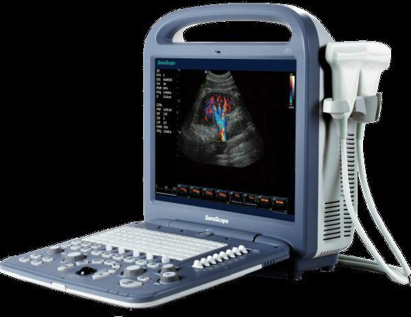 SonoScape S2 with one Linear array Probe L741 5.0-10.0 Mhz DIAGNOSTIC ULTRASOUND MACHINES FOR SALE