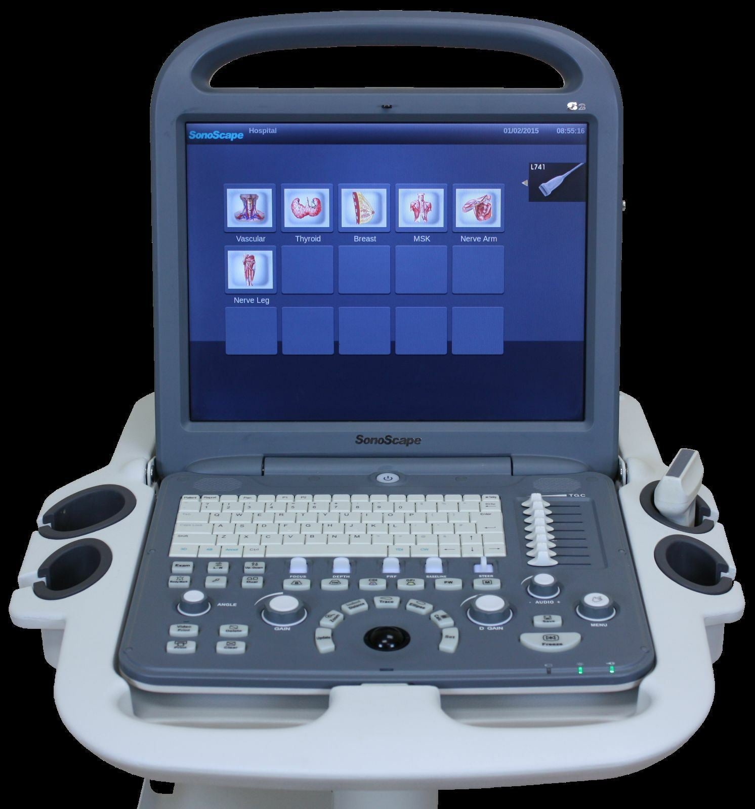 SonoScape S2 with Convex Abdominal Probe Included - Excellent Condition DIAGNOSTIC ULTRASOUND MACHINES FOR SALE