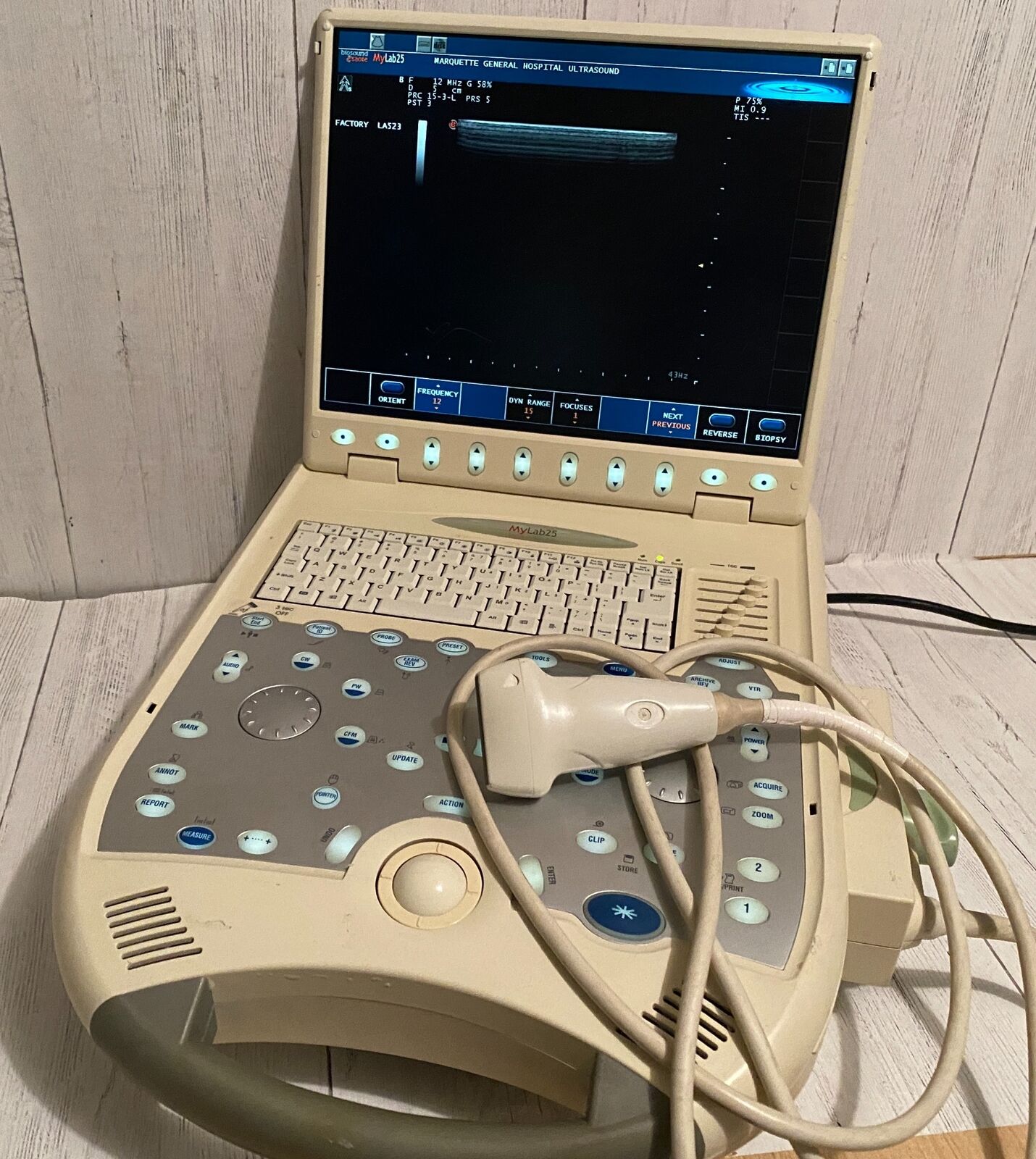 Esaote BioSound MyLab25 Portable Ultrasound with linear array probe 2005 DIAGNOSTIC ULTRASOUND MACHINES FOR SALE