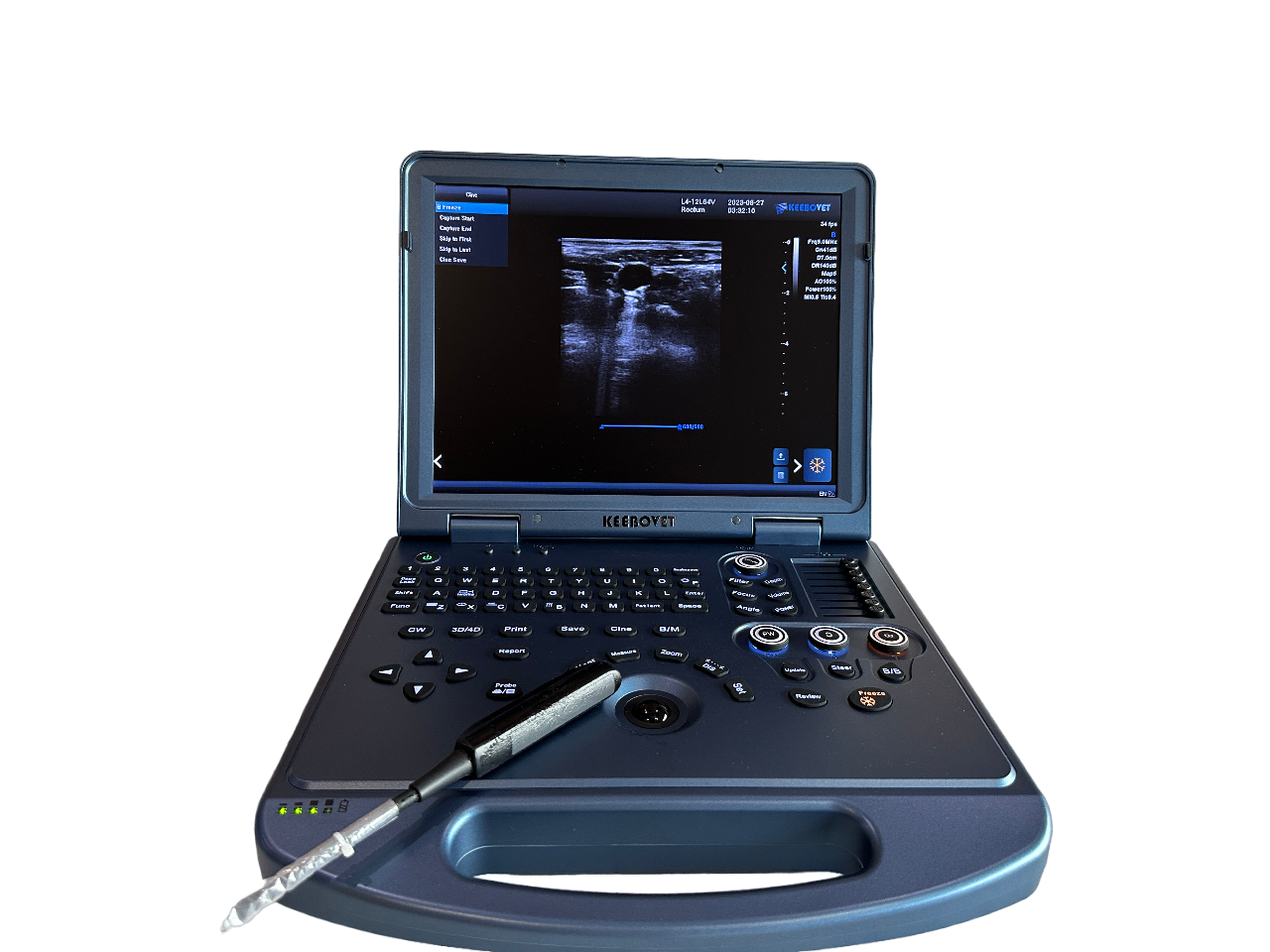 ECO-17Vet High end Equine Ultrasound with Rectal Probe 4-12 MHz Color Doppler DIAGNOSTIC ULTRASOUND MACHINES FOR SALE