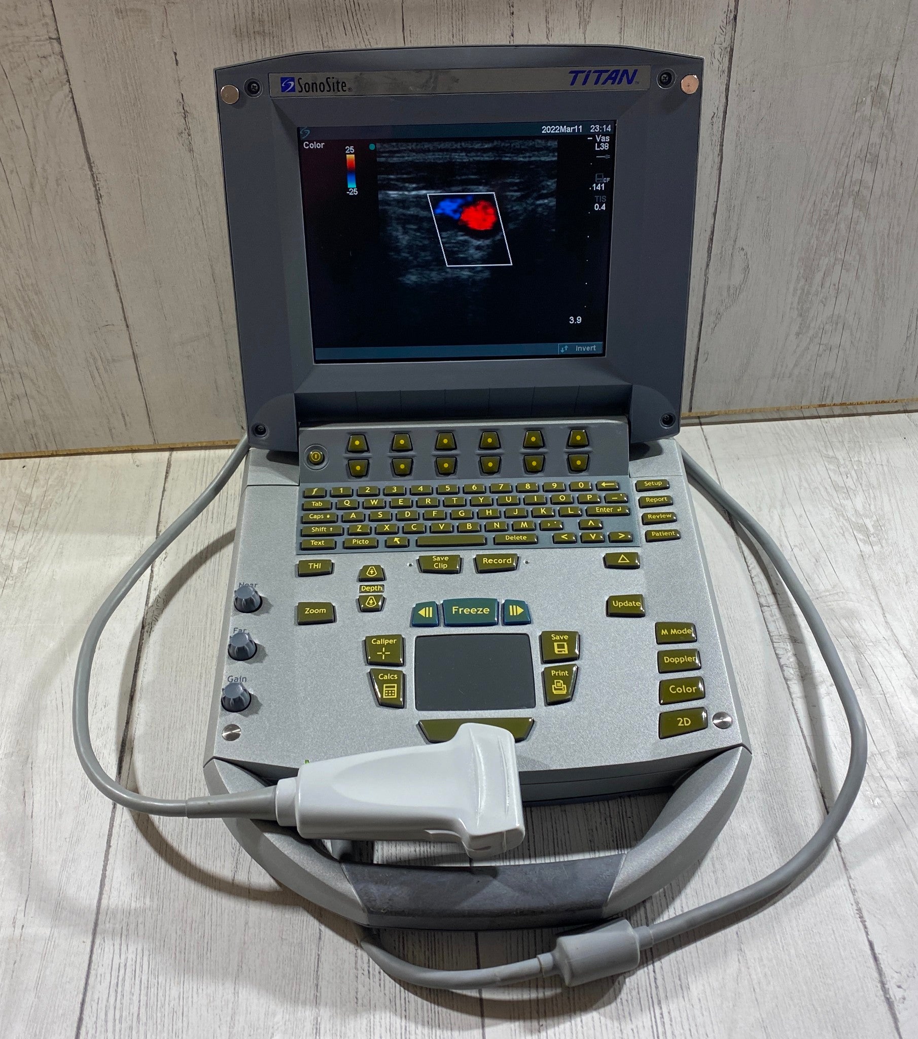 Sonosite Titan Portable Ultrasound 2005 - With Linear Array probe L25 Probe DIAGNOSTIC ULTRASOUND MACHINES FOR SALE