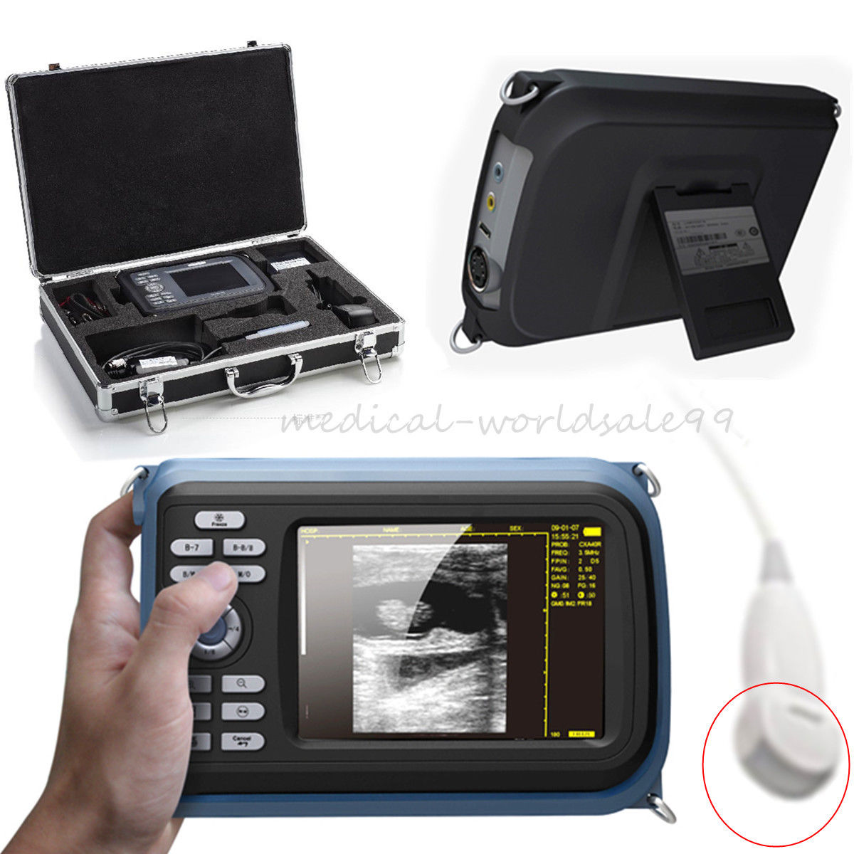 Digital Handheld Ultrasound Scanner Ultrasound Machine Micro-Convex Probe A+ DIAGNOSTIC ULTRASOUND MACHINES FOR SALE