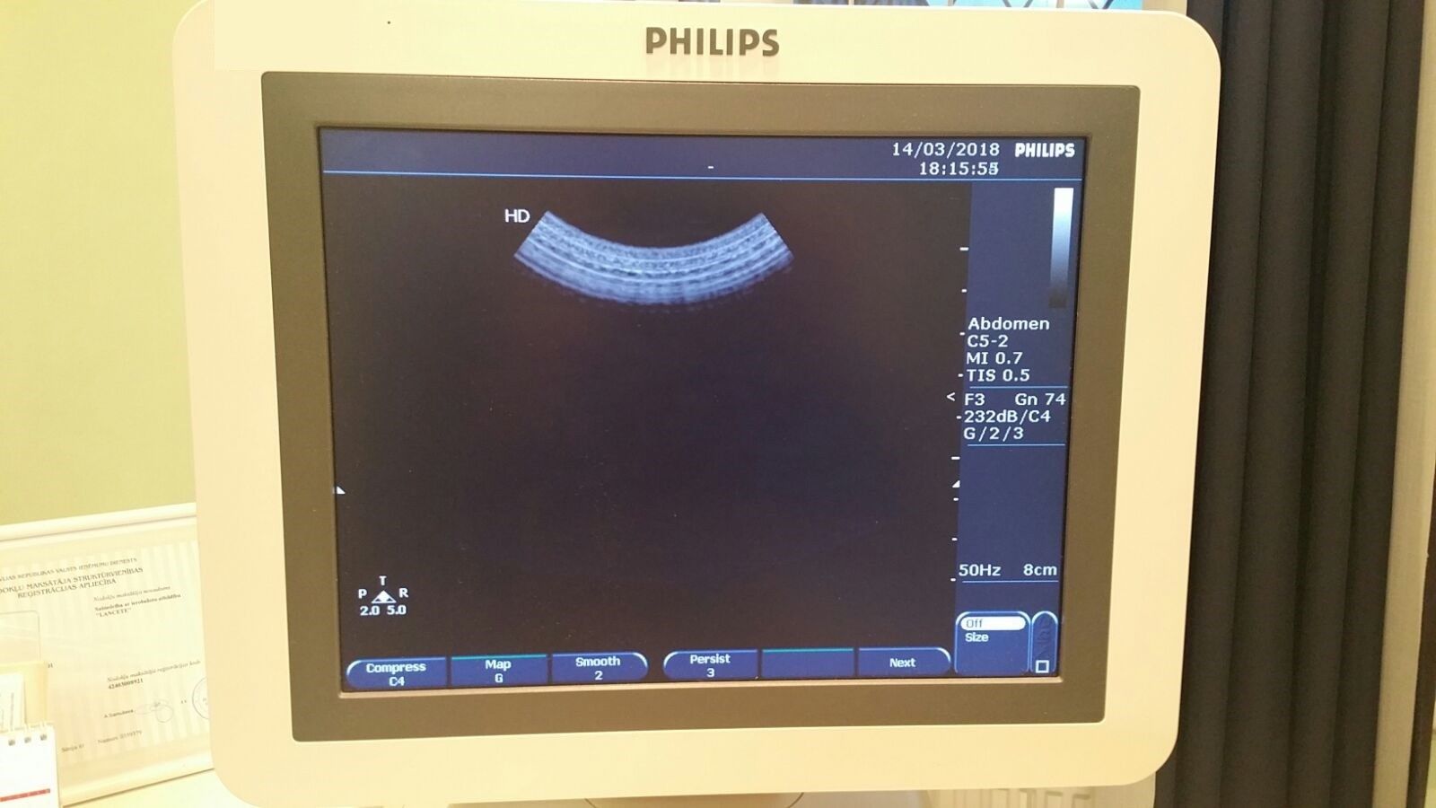 Philips HD7 Revision 1.1 Diagnostic Ultrasound System DIAGNOSTIC ULTRASOUND MACHINES FOR SALE