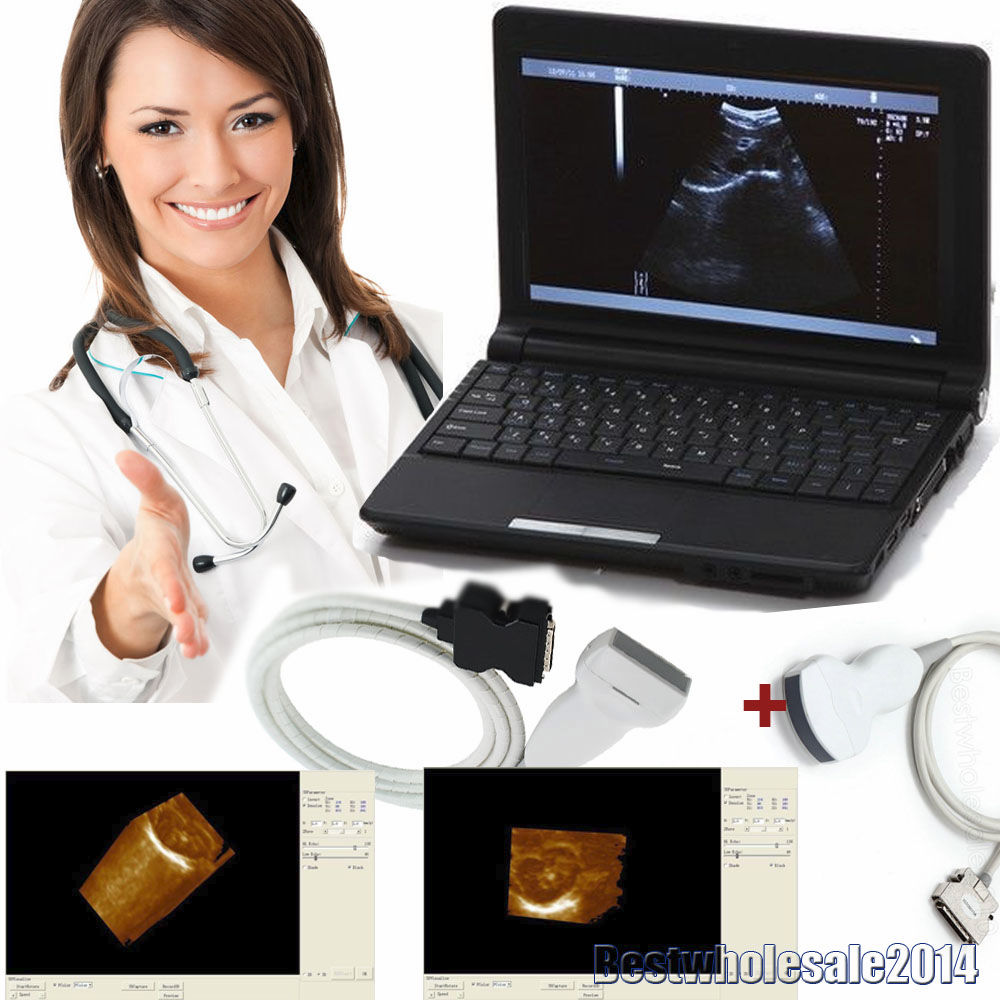 Digital Laptop Ultrasound Scanner Convex + Linear Probe 3D Ultrasound Pregnant DIAGNOSTIC ULTRASOUND MACHINES FOR SALE