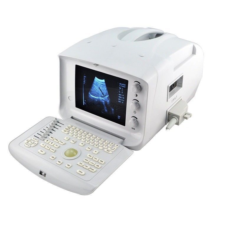 Digital Ultrasound Scanner Machine+Convex +Micro-convex 2 Probes + Oximeter Sale DIAGNOSTIC ULTRASOUND MACHINES FOR SALE