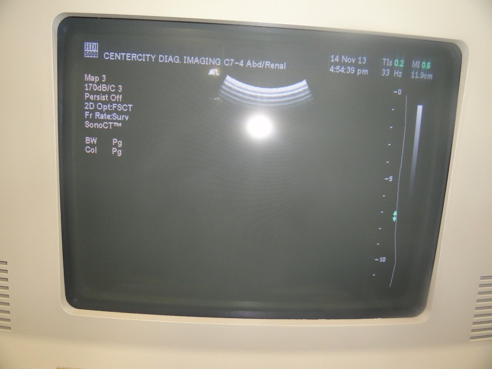 ATL C7-4 40R Curved Array Convex Abdominal Probe for ATL HDI Series (5965 ) DIAGNOSTIC ULTRASOUND MACHINES FOR SALE