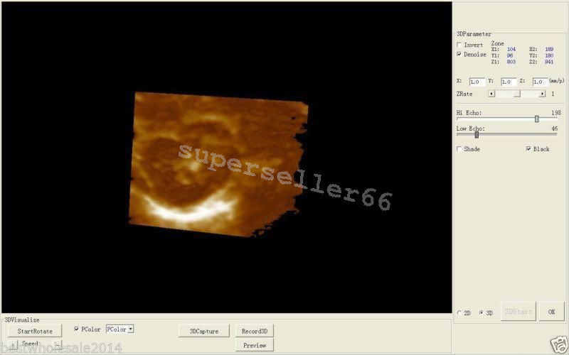 Portable Laptop Digital LCD 10.1 Inch Ultrasound scanner with Transvaginal Probe 190891563705 DIAGNOSTIC ULTRASOUND MACHINES FOR SALE