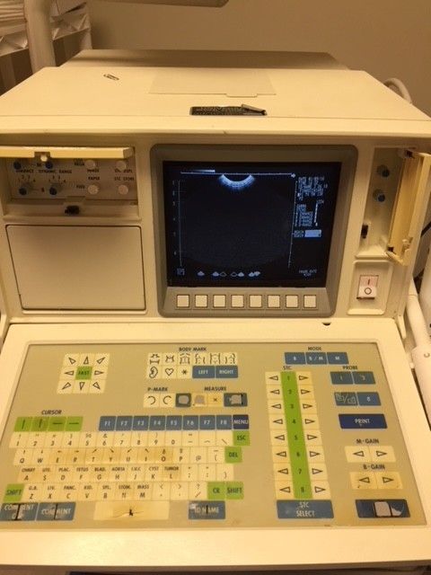 Shimadzu SDL-310 ultrasound machine with thermal printer and monitor DIAGNOSTIC ULTRASOUND MACHINES FOR SALE