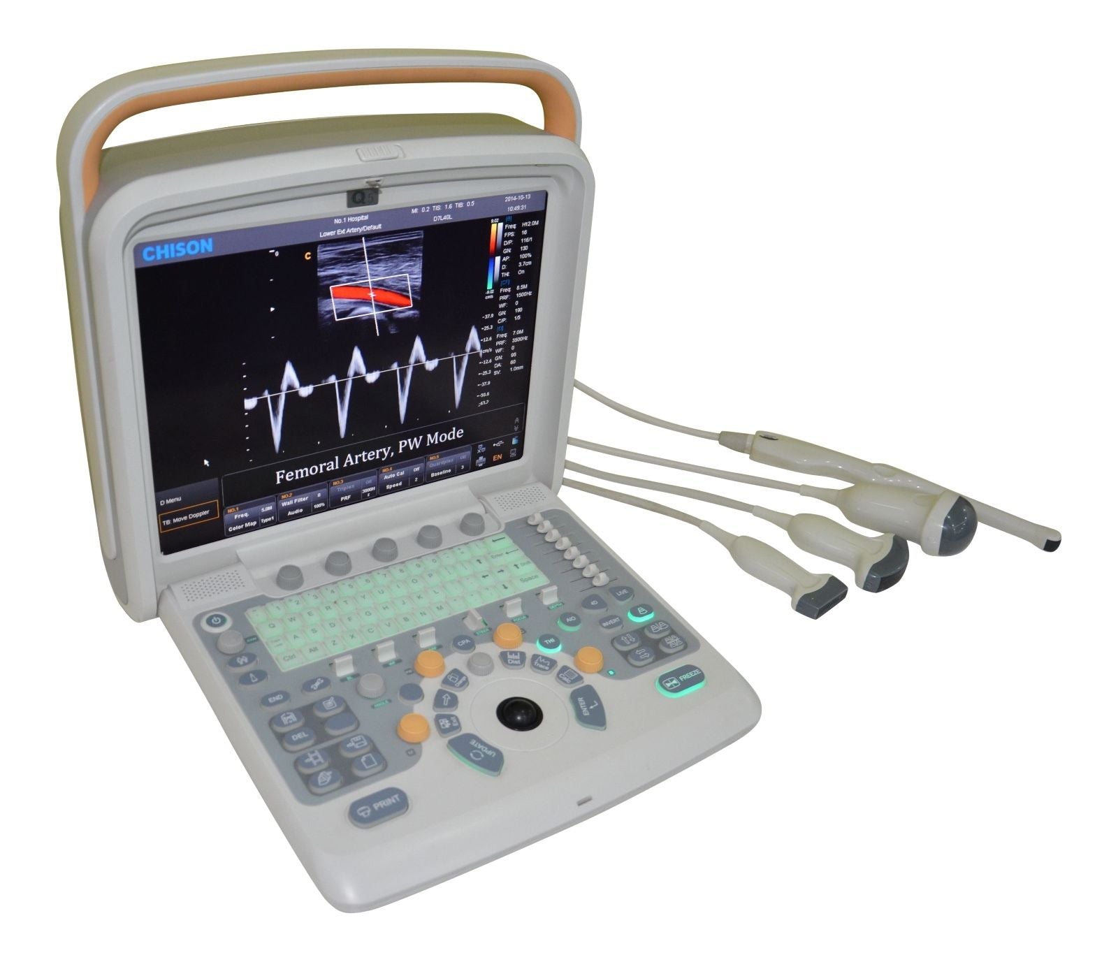 Color Doppler Ultrasound Machine With One Probe Affordable Chison Q5 DIAGNOSTIC ULTRASOUND MACHINES FOR SALE