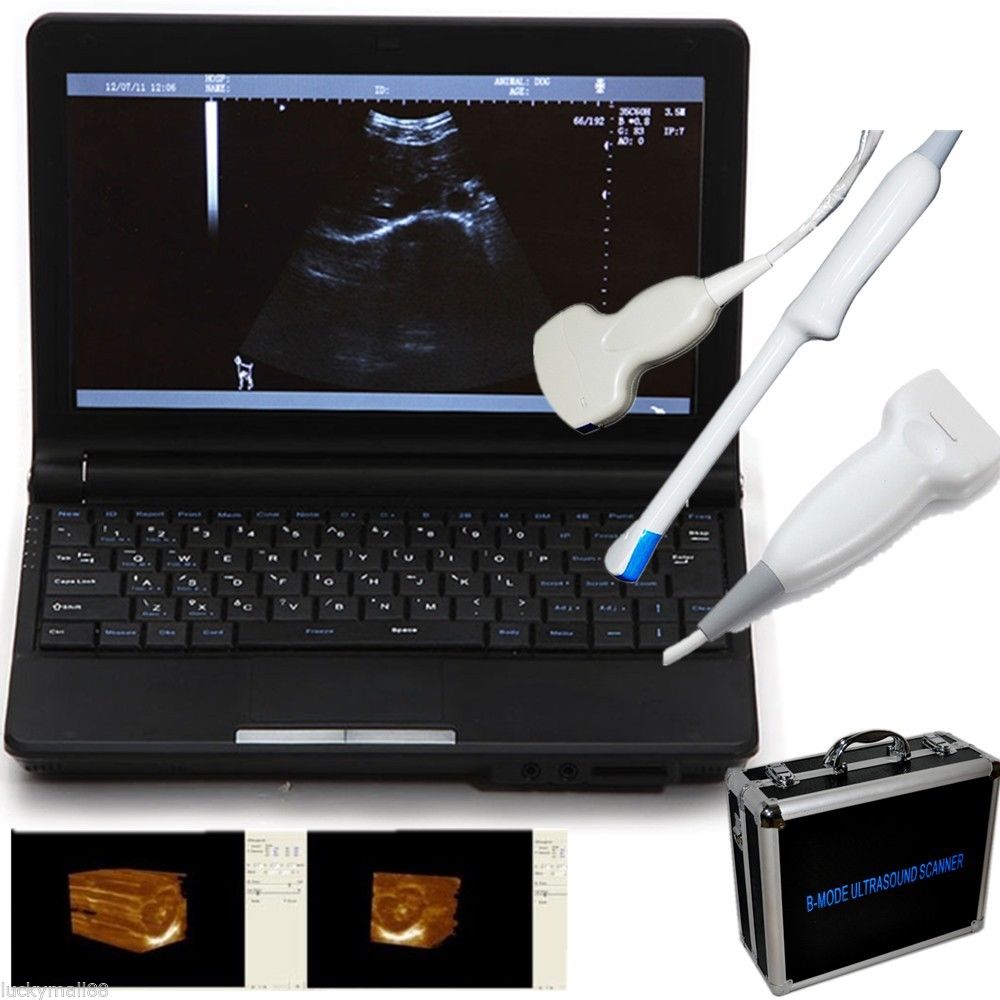 New Portable Ultrasound Scanner Machine Convex Linear Transvaginal Probe Set A 190891046307 DIAGNOSTIC ULTRASOUND MACHINES FOR SALE