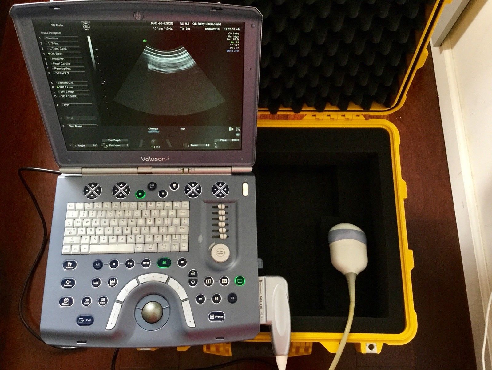 GE Voluson i Portable Ultrasound System and 4D Transducer probe, Protective case DIAGNOSTIC ULTRASOUND MACHINES FOR SALE