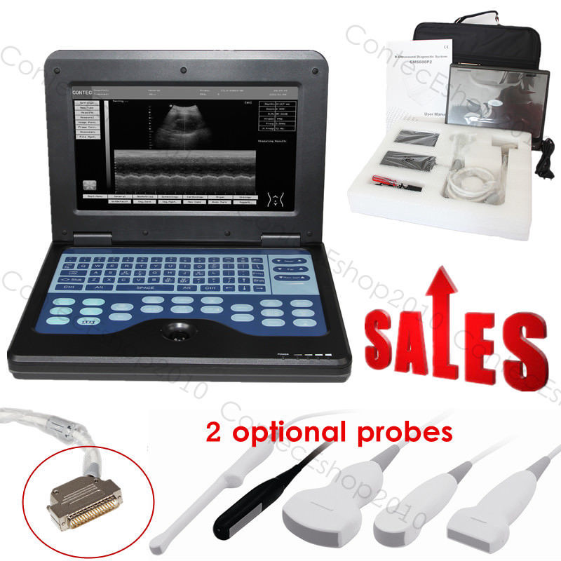 Portable Laptop Machine Digital Ultrasound Scanner, probe, human/vet, USA Fedex DIAGNOSTIC ULTRASOUND MACHINES FOR SALE