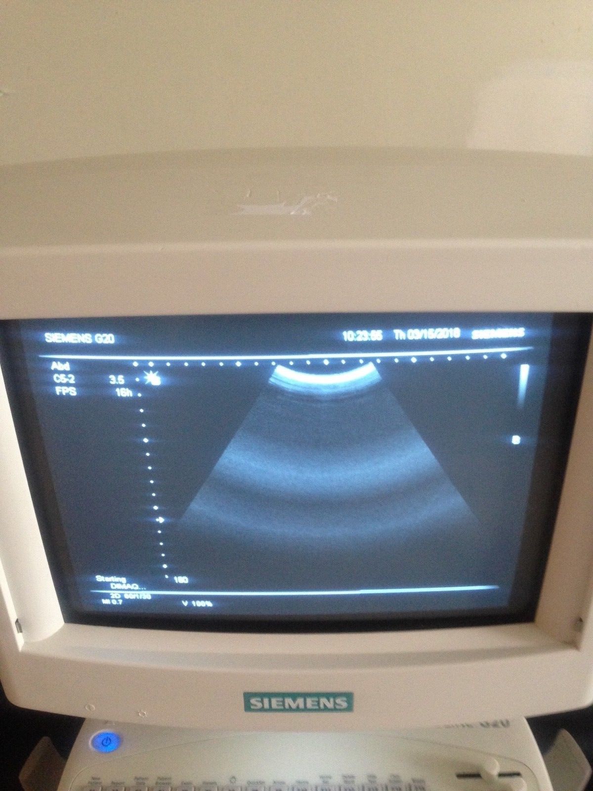 Siemens SONOLINE G20 Ultrasound System DIAGNOSTIC ULTRASOUND MACHINES FOR SALE