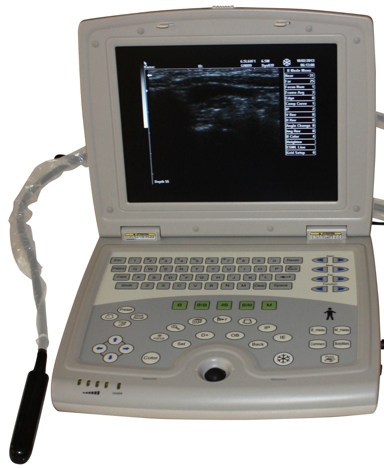 Portable Digital Ultrasound Device, Farm Animals-Equine Bovine KeeboMed KX5000KV DIAGNOSTIC ULTRASOUND MACHINES FOR SALE