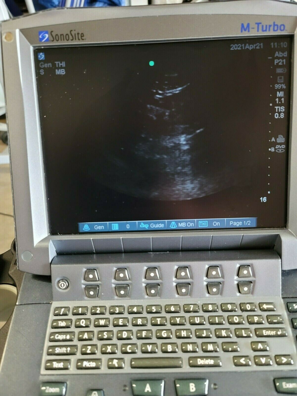 Sonosite M-Turbo Ultrasound System with Probe P21x (5-1MHz) DIAGNOSTIC ULTRASOUND MACHINES FOR SALE