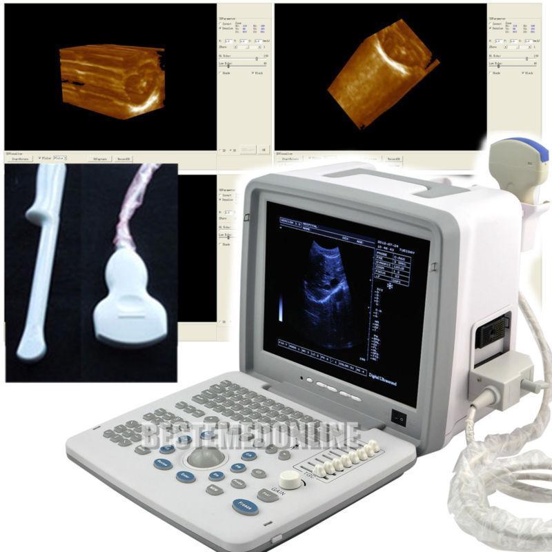 LCD Digital Ultrasound Scanner/Machine Convex Transvaginal Probes +3D Version CE 190891688125 DIAGNOSTIC ULTRASOUND MACHINES FOR SALE