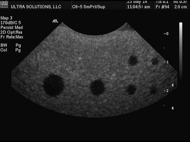 ATL Curved Array C8-5 14R Utlrasound Probe DIAGNOSTIC ULTRASOUND MACHINES FOR SALE