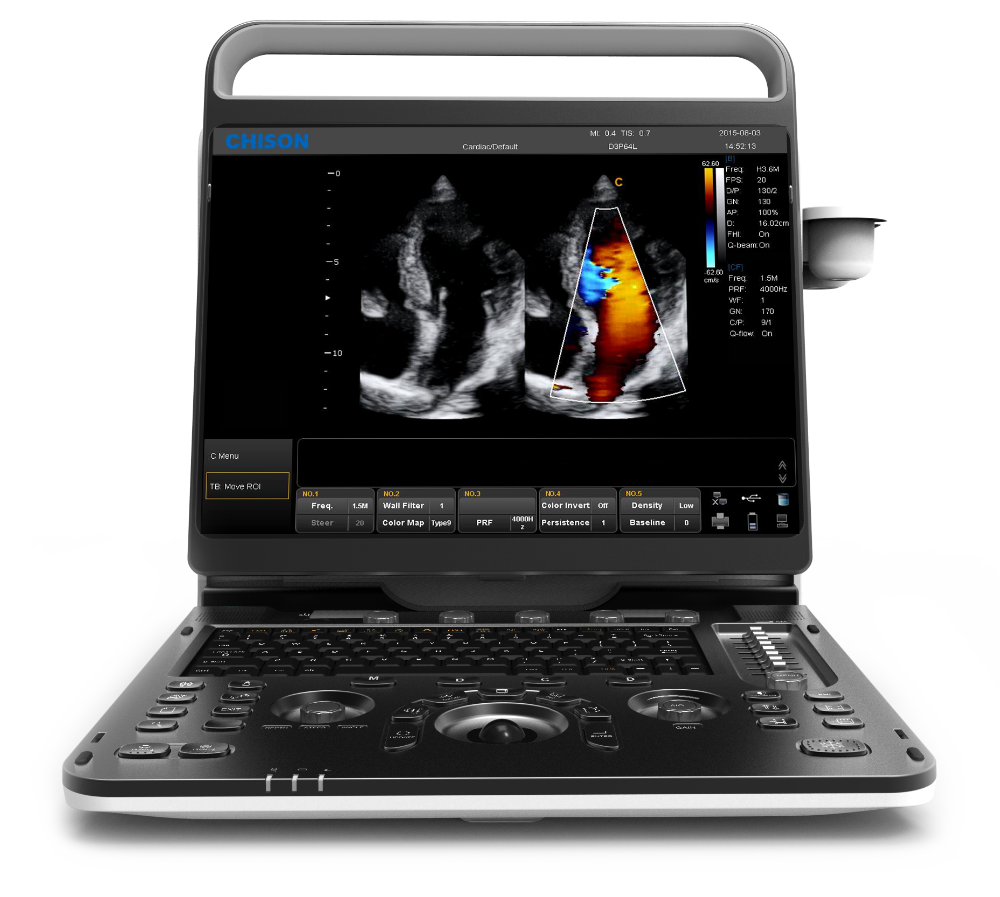 NEW Chison EBit 30 Portable Ultrasound System DIAGNOSTIC ULTRASOUND MACHINES FOR SALE