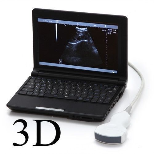 Laptop Ultrasound Scanner Diagnostic DiagnosisMachine Convex Probe Sale CE DIAGNOSTIC ULTRASOUND MACHINES FOR SALE