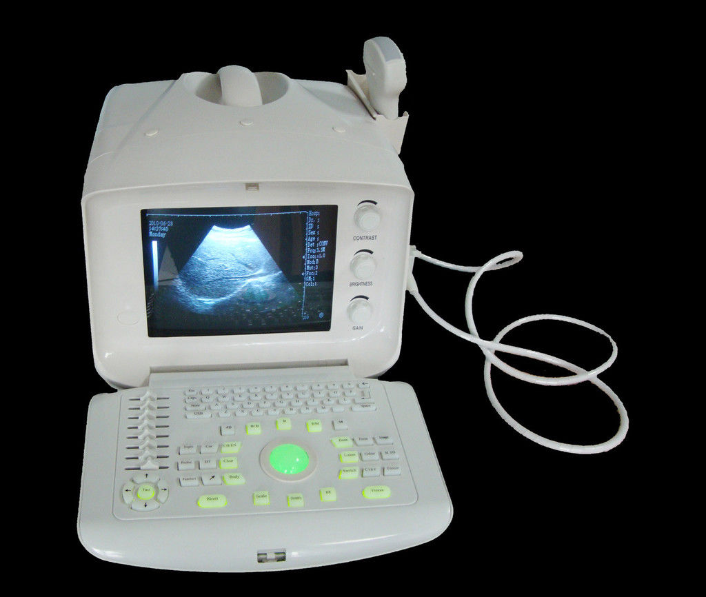 Digital Ultrasound Scanner Ultrasonic Machine Convex Micro-Cardiac 2Probe 3D A+ 190891391452 DIAGNOSTIC ULTRASOUND MACHINES FOR SALE