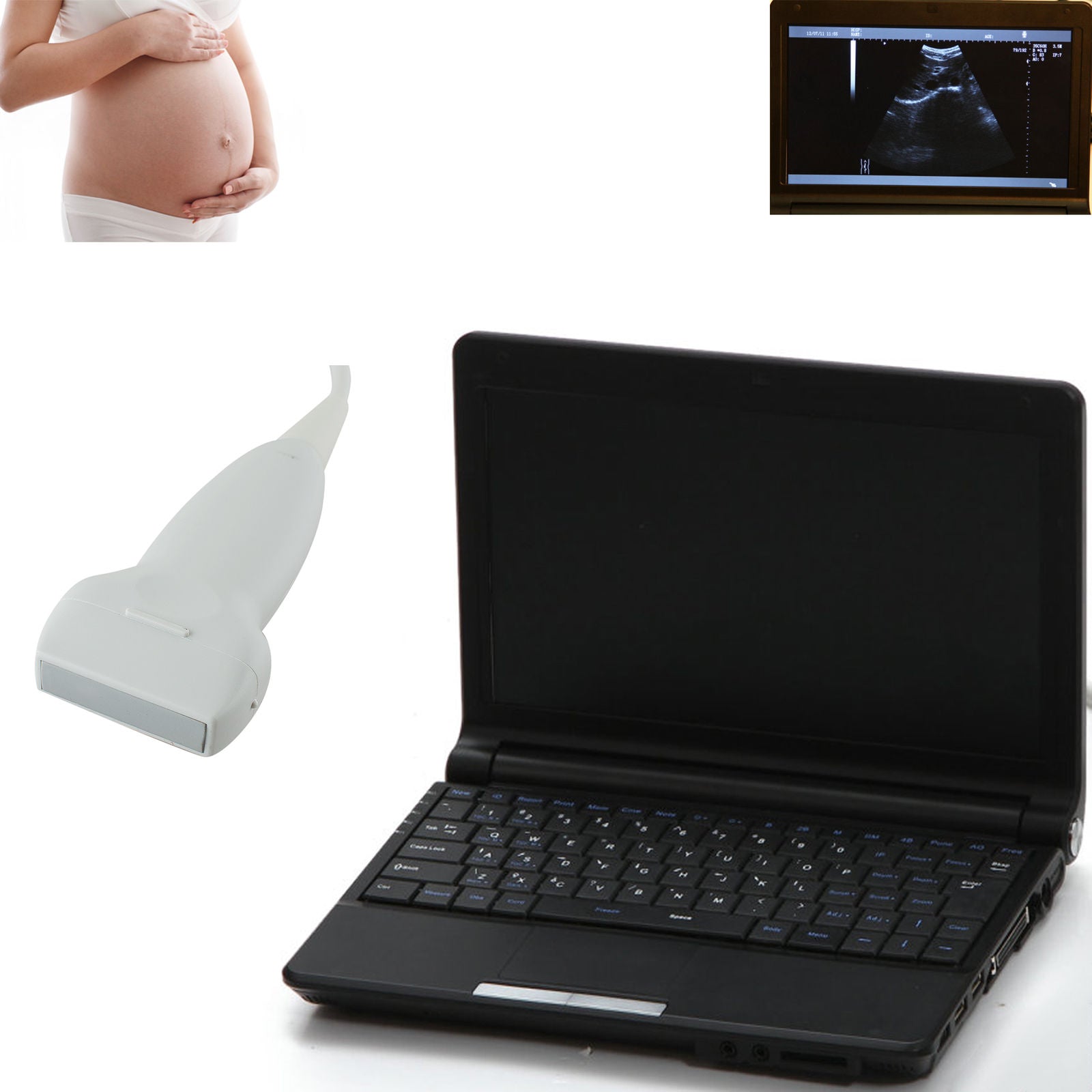 Digital Laptop Ultrasound Scanner+7.5MHz Linear Probe+ External 3D Work Station DIAGNOSTIC ULTRASOUND MACHINES FOR SALE