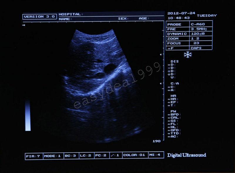 Full Digital Portable Ultrasound Scanner Machine Convex Transvaginal 2 Probes 3D 190891678171 DIAGNOSTIC ULTRASOUND MACHINES FOR SALE