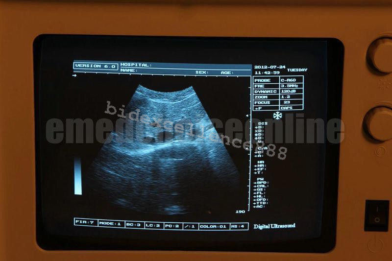 Ultrasound Machine Scanner System Linear Probe + Oximeter Portable Machine CE DIAGNOSTIC ULTRASOUND MACHINES FOR SALE