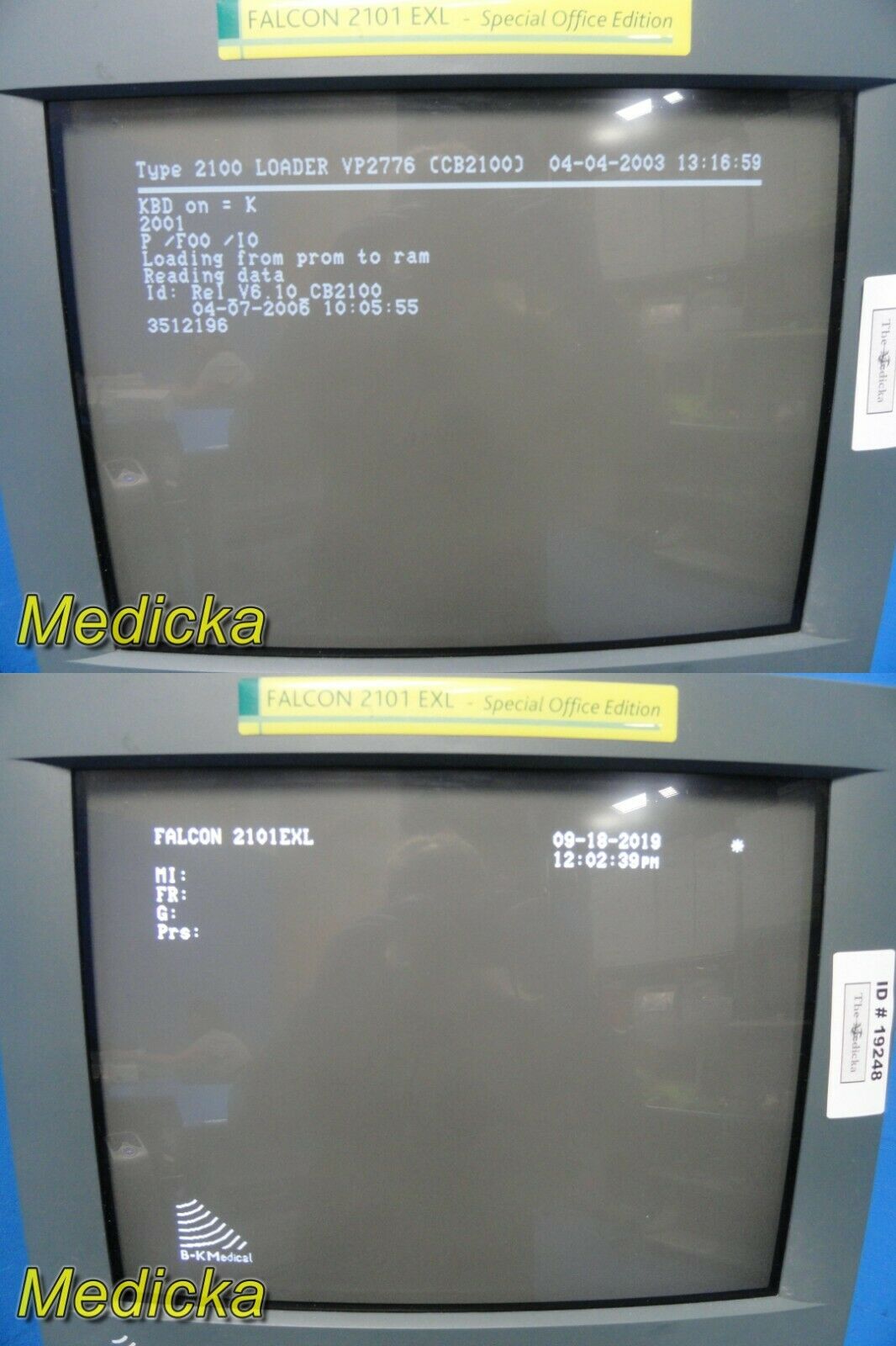 B-K Medical Falcon 2101 EXL Special Office Edition Ultrasound Machine ~ 19248 DIAGNOSTIC ULTRASOUND MACHINES FOR SALE