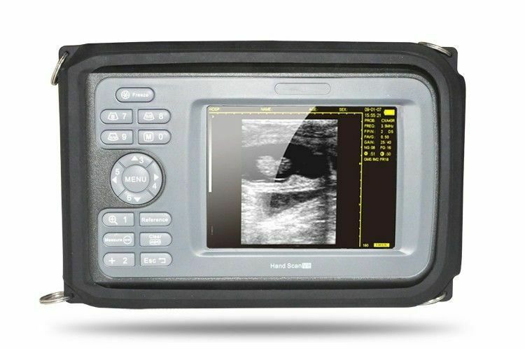 Digital LCD Ultrasound Scanner Machine Human Use With R40 3.5Mhz Convex Probe DIAGNOSTIC ULTRASOUND MACHINES FOR SALE