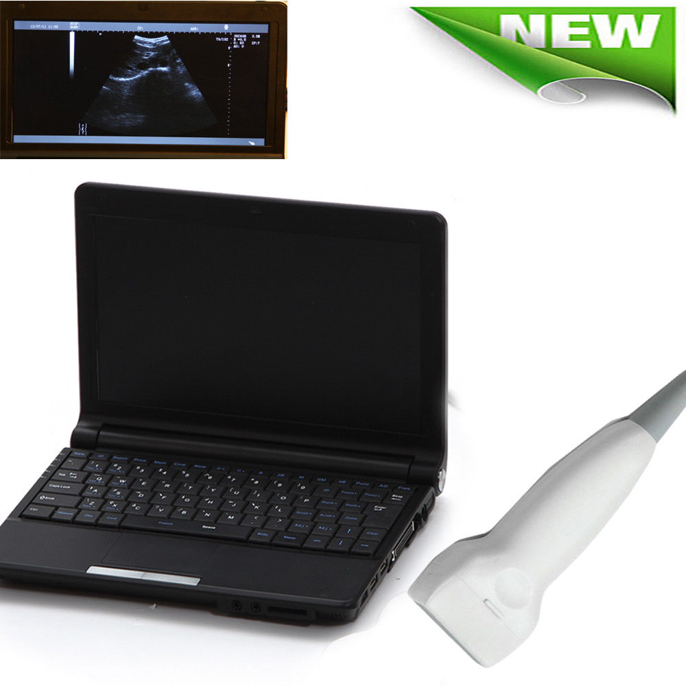 Digital Laptop Ultrasound Scanner machine system 7.5MHZ Linear Sensor/Probe+3D DIAGNOSTIC ULTRASOUND MACHINES FOR SALE