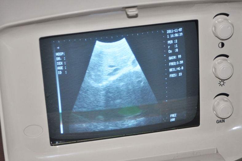 NEW +3D Diagnostic Ultrasound Scanner convex +linear two probes Test A Class Kit 190891566379 DIAGNOSTIC ULTRASOUND MACHINES FOR SALE