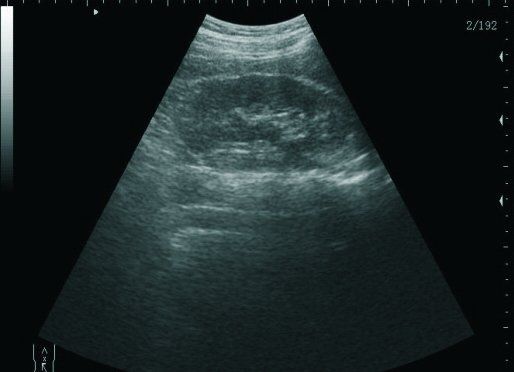 Vet Digital Laptop Veterinary Ultrasound Scanner Machine+ Rectal probe 3D A+ 190891426246 DIAGNOSTIC ULTRASOUND MACHINES FOR SALE