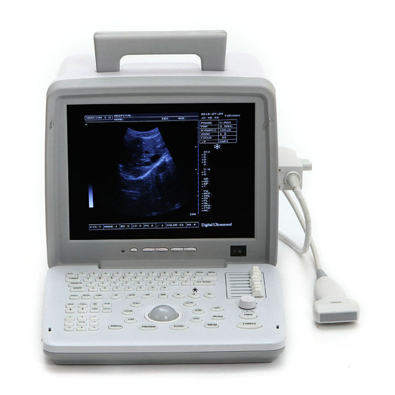 High Image Full Digital Portable Ultrasound Scanner Machine Convex &Linear probe 190891609588 DIAGNOSTIC ULTRASOUND MACHINES FOR SALE