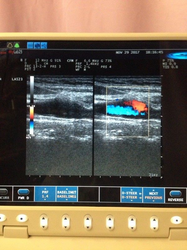 ultrasound machine- 2008 biosound esaote mylab 25 ultrasound, LA 523 probe DIAGNOSTIC ULTRASOUND MACHINES FOR SALE