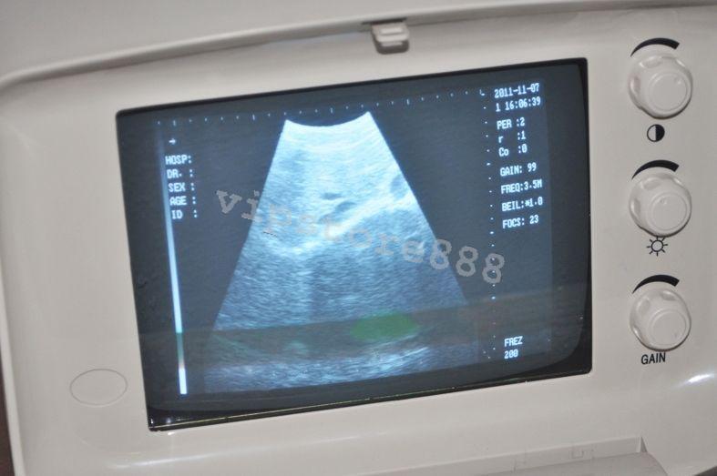 Digital Ultrasound Scanner Machine +Convex +Vaginal + Linear 3 Probes/Sensor+3D DIAGNOSTIC ULTRASOUND MACHINES FOR SALE