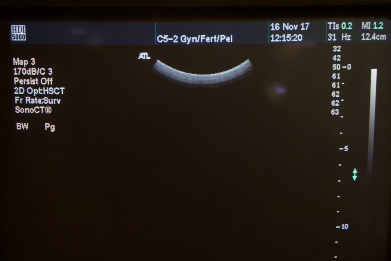Philips ATL C5-2 40R Curved Array Ultrasound Transducer HDI5000 4000-0574-05 DIAGNOSTIC ULTRASOUND MACHINES FOR SALE