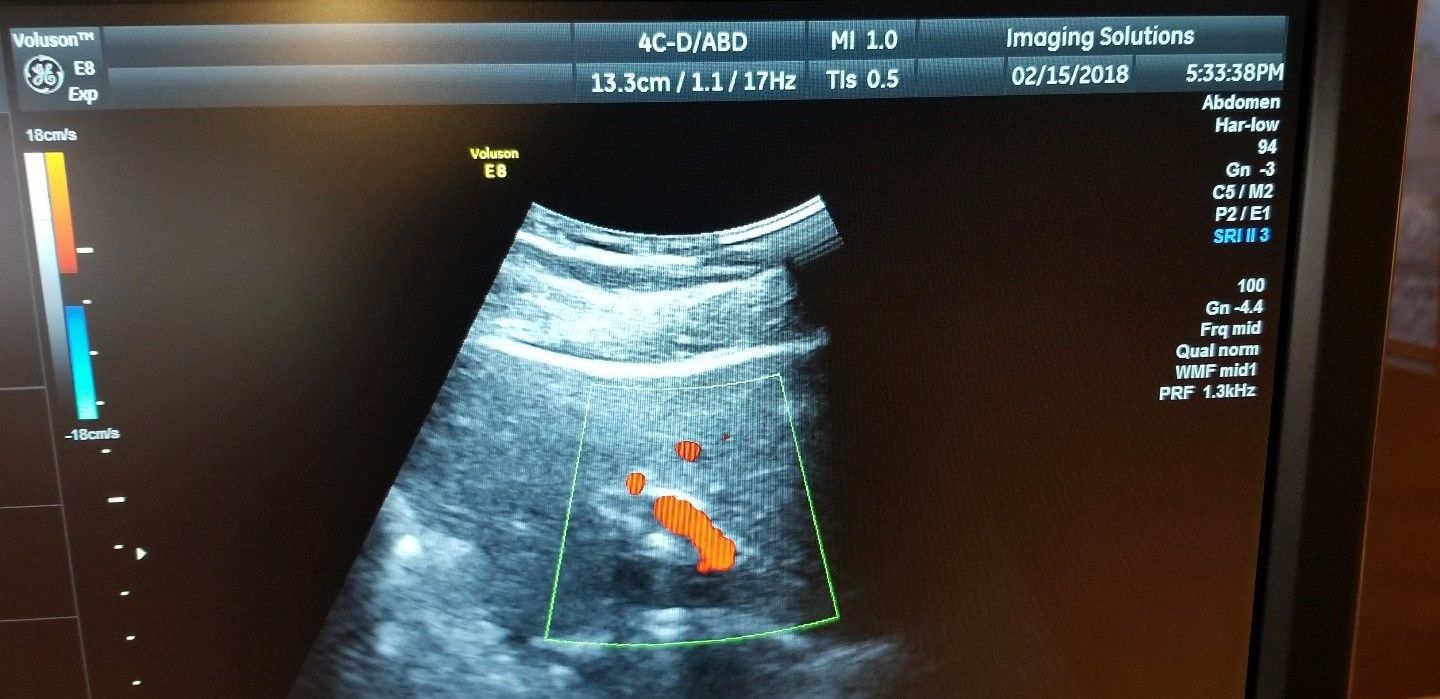 GE Health Care 4C-D Ultrasound Transducer