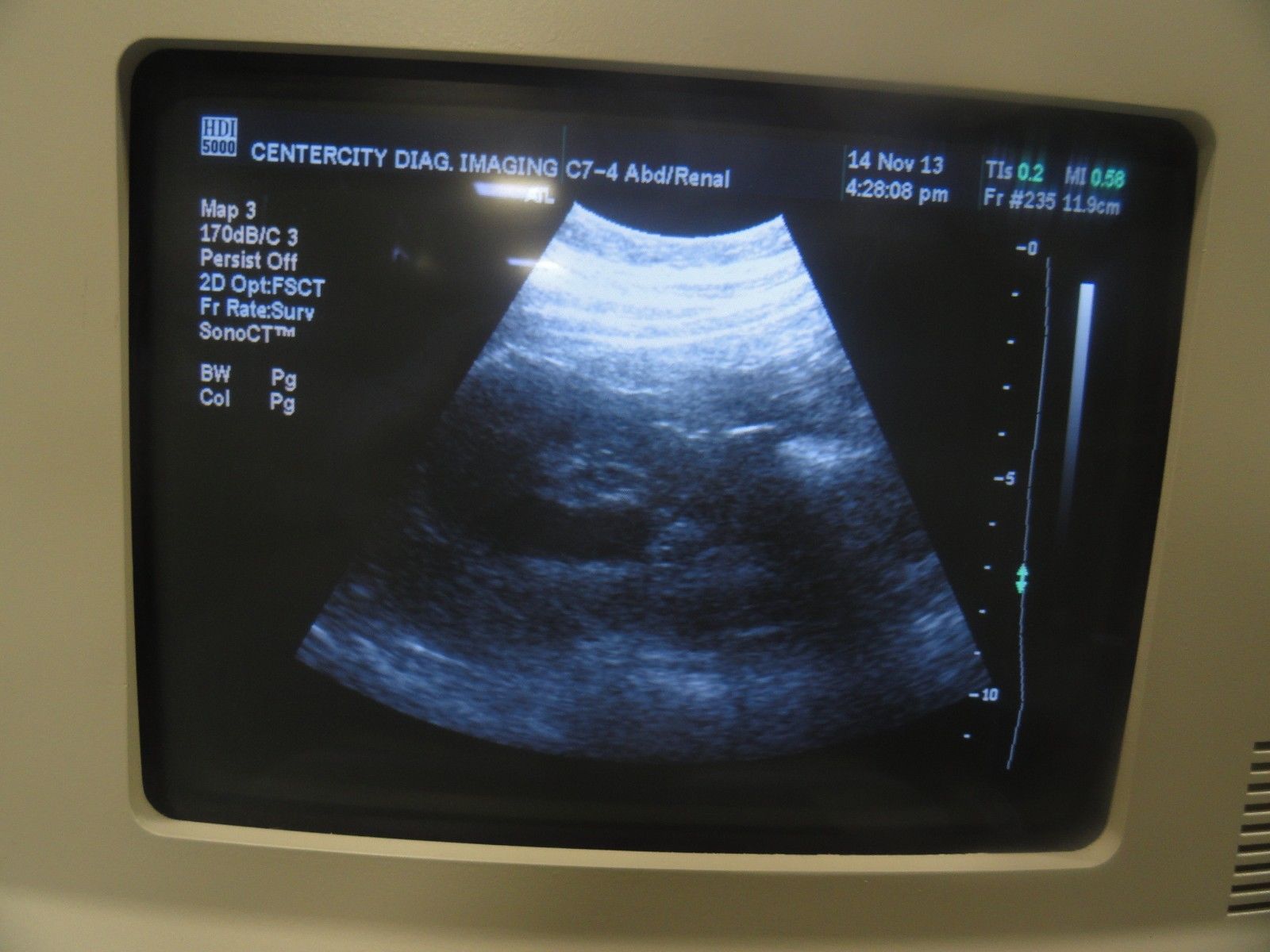 2009 Philips C7-4 40R Curved Array Convex Probe for ATL HDI Series (5963 ) DIAGNOSTIC ULTRASOUND MACHINES FOR SALE