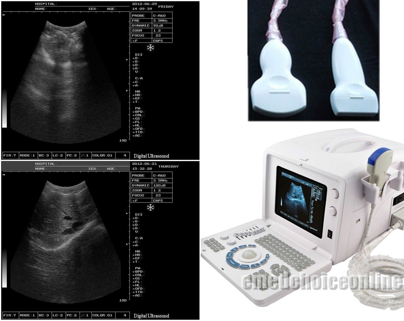 New Digital Ultrasound machine Scanner System Convex + linear Probe +3D Recorder DIAGNOSTIC ULTRASOUND MACHINES FOR SALE