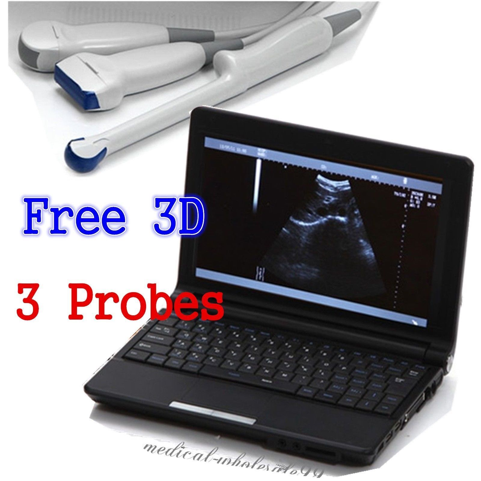 Digital Laptop Machine Ultrasound Scanner +Convex& Vignal &Linear 3 Probe &3D DIAGNOSTIC ULTRASOUND MACHINES FOR SALE