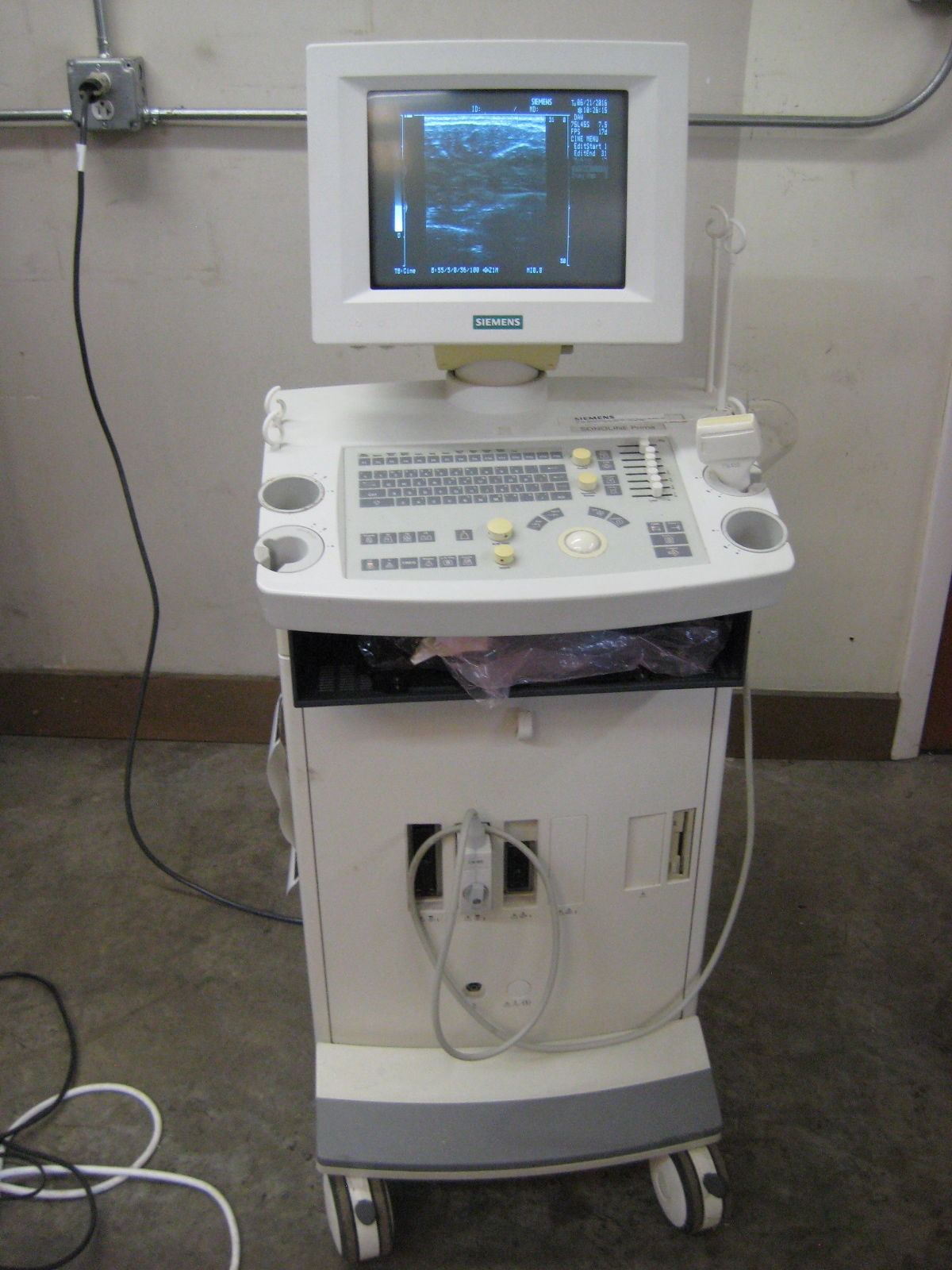 Siemens Sonoline Prima Ultrasound with Linear probe and printer. Guaranteed DIAGNOSTIC ULTRASOUND MACHINES FOR SALE