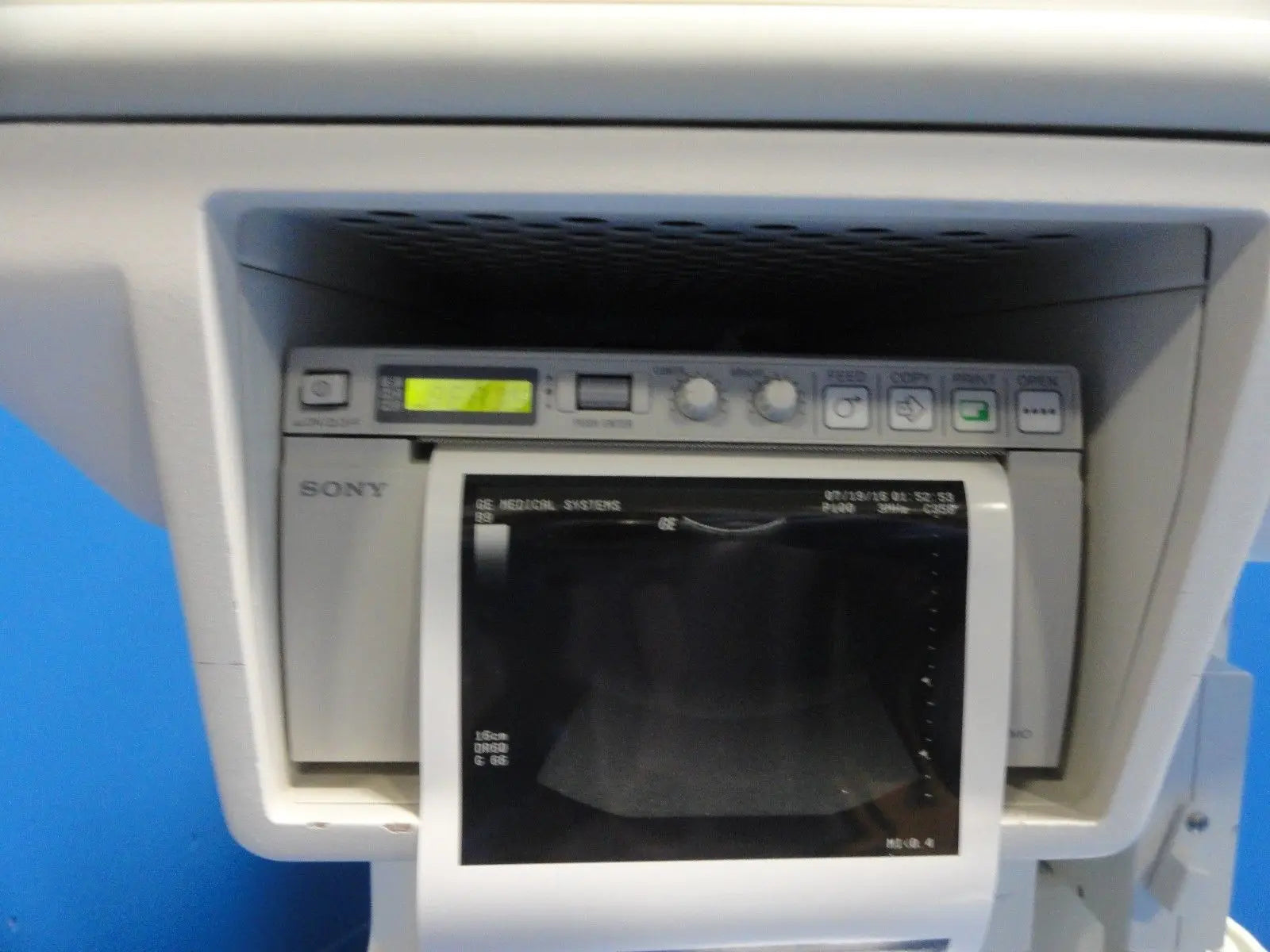 GE Logiq 500 Pro Series Ultrasound W/ C358, S222, LA39 Probes & Printer ~ 13875 DIAGNOSTIC ULTRASOUND MACHINES FOR SALE