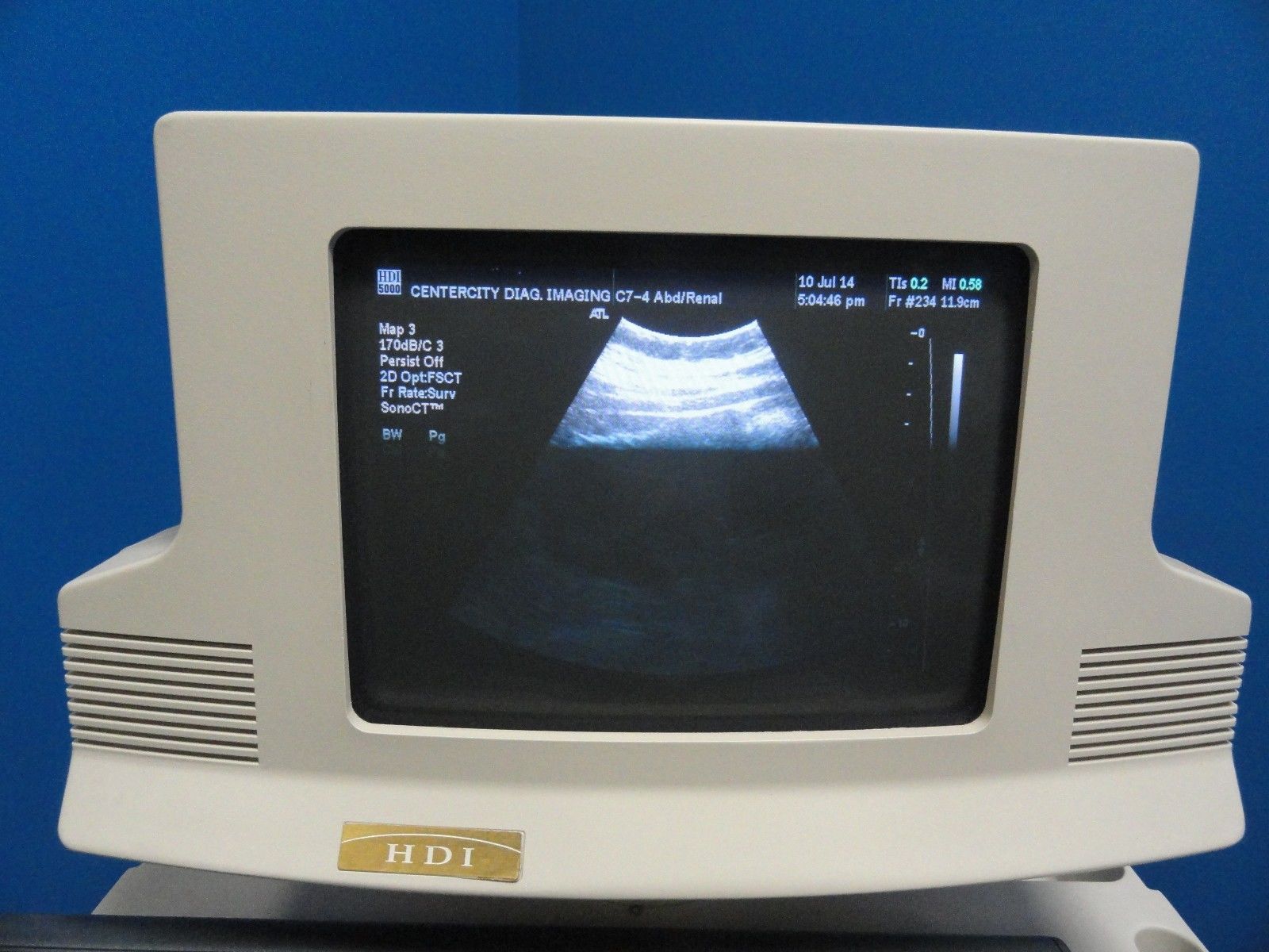 ATL C7-4 40R Curved Array Convex Ultrasound Probe for ATL HDI Series (6867) DIAGNOSTIC ULTRASOUND MACHINES FOR SALE