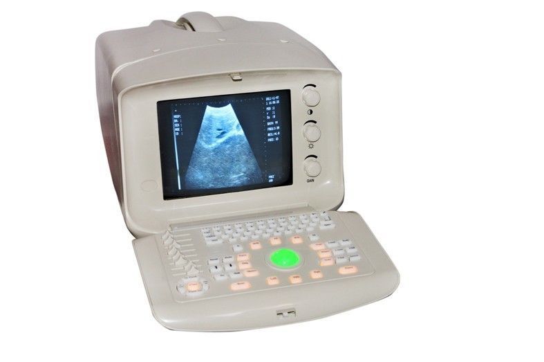 Digital Ultrasound Scanner Machine+Convex +Micro-convex 2 Probes + Oximeter Sale DIAGNOSTIC ULTRASOUND MACHINES FOR SALE