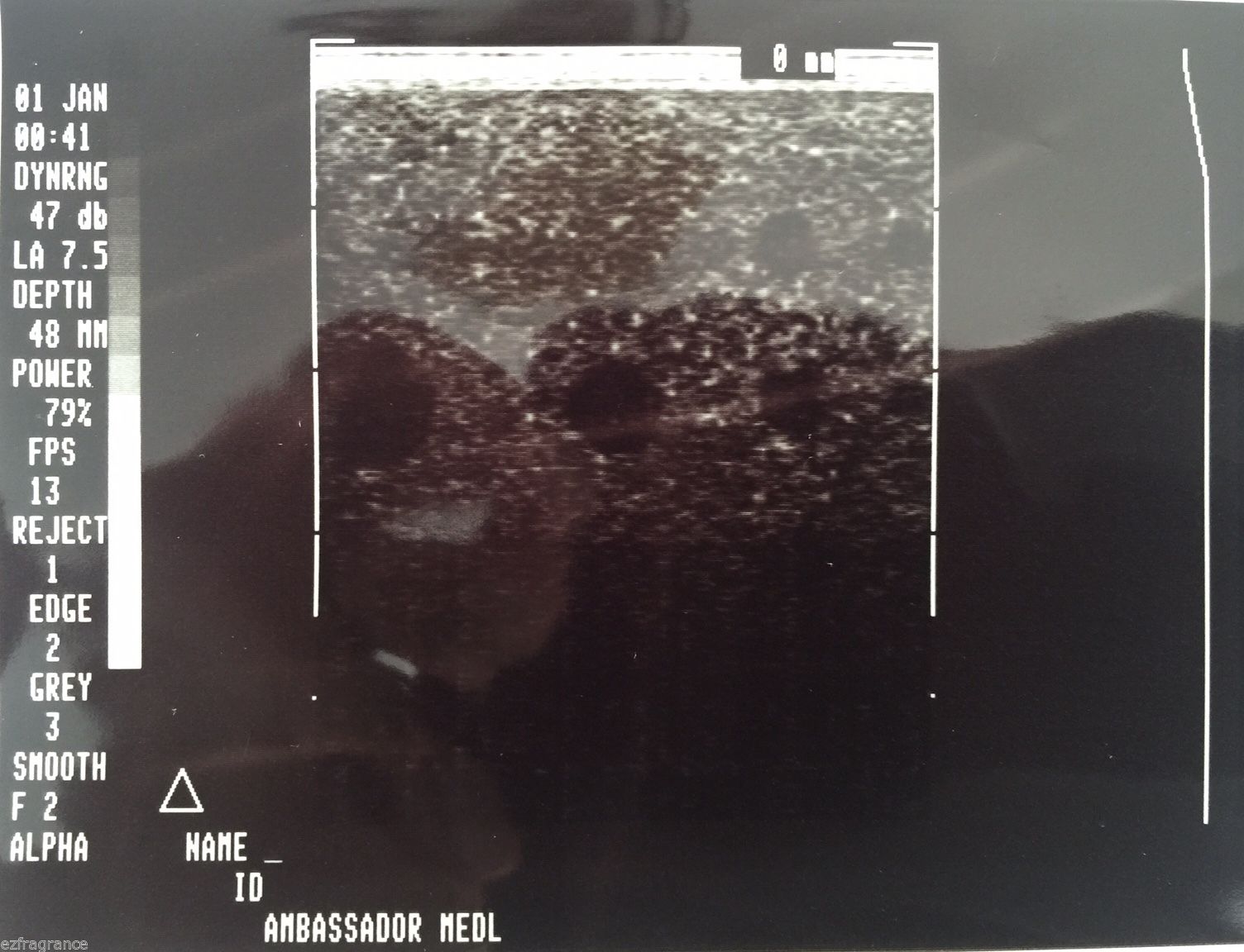 ATL LA 7.5 MHz.HR Linear Array Ultrasound Probe / Transducer.USED full-tested DIAGNOSTIC ULTRASOUND MACHINES FOR SALE