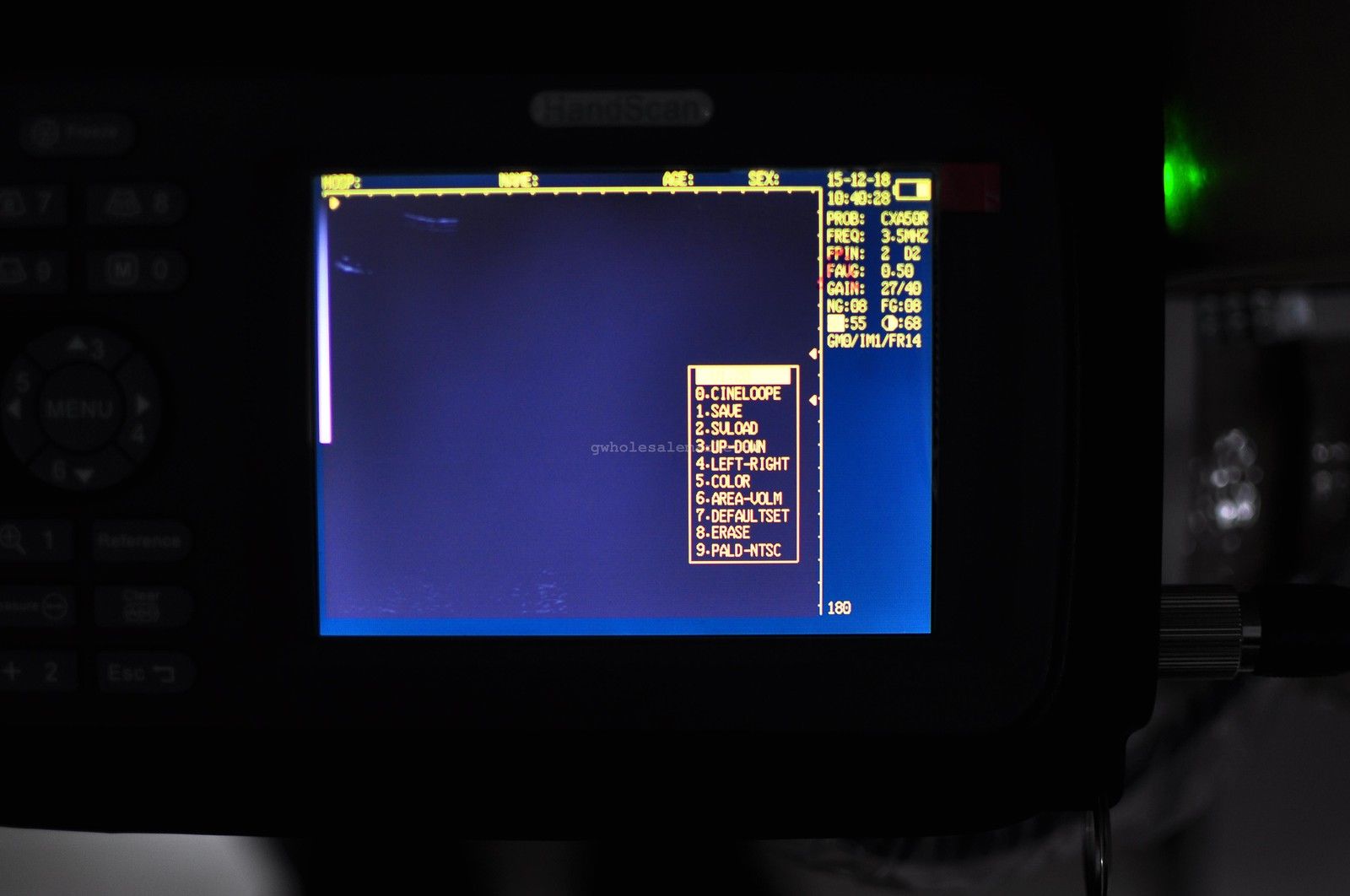 Veterinary VET pet Ultrasound Scanner Machine Animal Rectal Probe + Oximeter US 190891057464 DIAGNOSTIC ULTRASOUND MACHINES FOR SALE