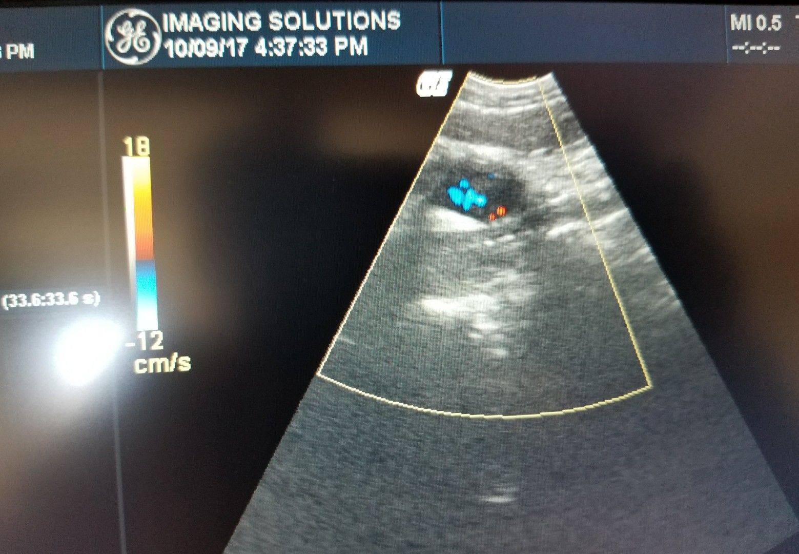 GE 8C-RS Probe / Transducer Micro-Convex DIAGNOSTIC ULTRASOUND MACHINES FOR SALE