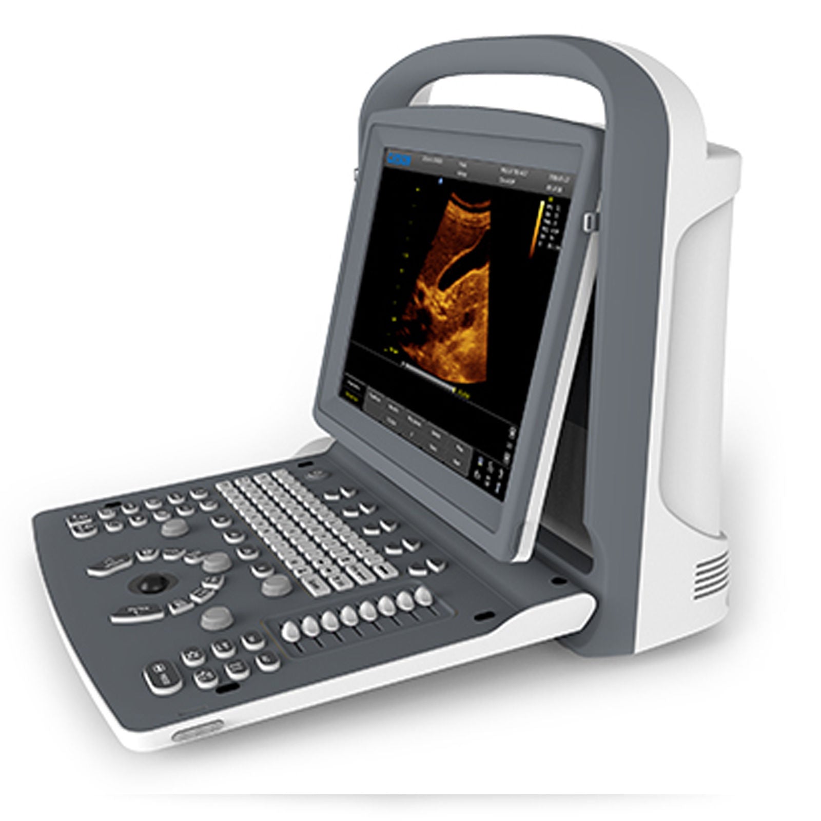 ECO2 Chison Portable Digital Ultrasound Scanner+3.5MHz ConvexProbe+CASE all d DIAGNOSTIC ULTRASOUND MACHINES FOR SALE