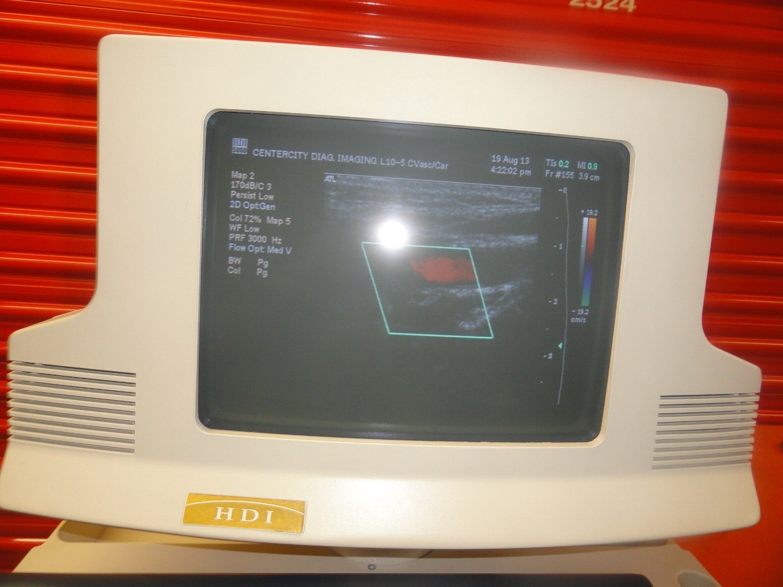 ATL L10-5 38 MM Linear Array Probe for Small parts Carotid & Vascular (5749 ) DIAGNOSTIC ULTRASOUND MACHINES FOR SALE