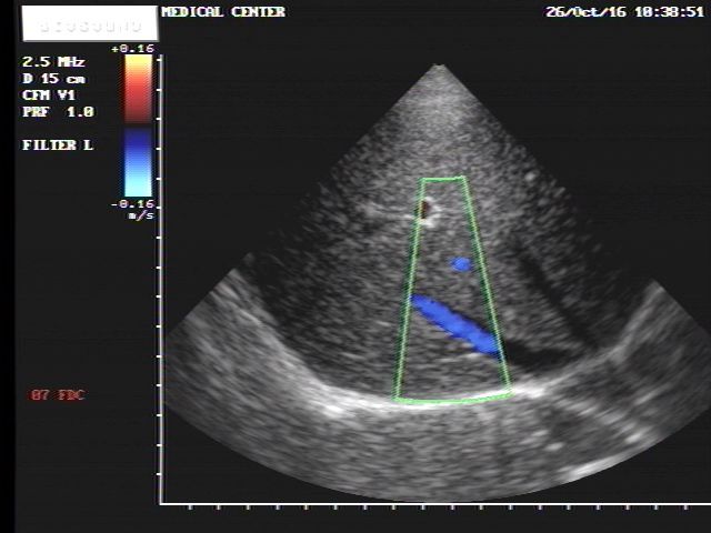 Esaote Biosound Megas/ MyLab ultrasound PA220 cardiac probe DIAGNOSTIC ULTRASOUND MACHINES FOR SALE
